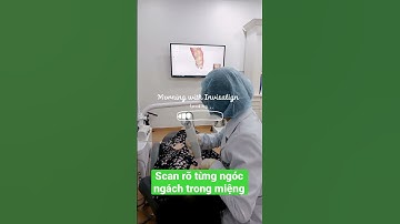 Biết rõ từng ngóc ngách răng miệng bằng máy scan 3D #platinumdentalgroup #invisalign