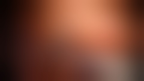 Single Port VATS RULobectomy using Powered Vascular Stapler (35mm)