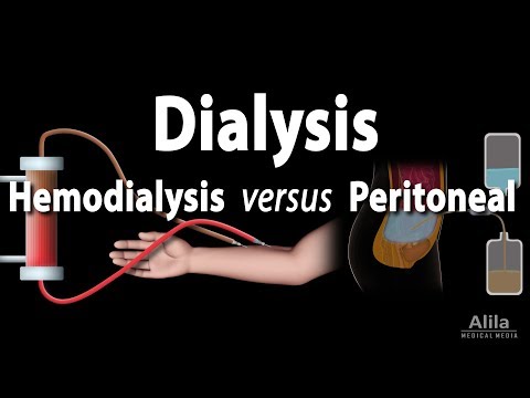 Video: Kura ir labāka hemodialīze vai peritoneālā dialīze?