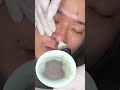#asmr #asmrsounds #Bubble毛穴洗浄#毛穴洗浄 #毛穴吸引 #大阪天王寺