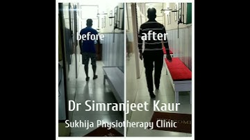 We have live results. #walk difficulty #gait improvements #severepains #leg