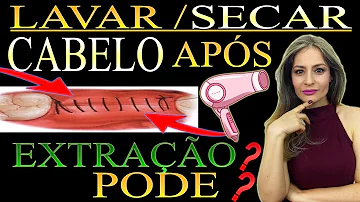 Pode tomar banho depois de tirar o siso?