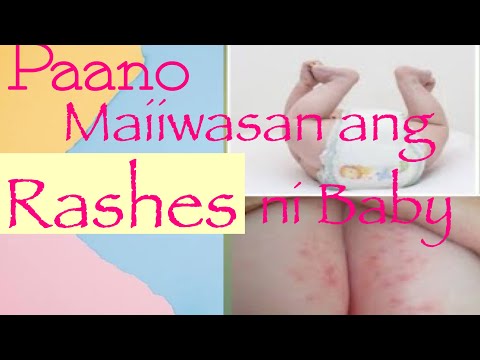 Video: Paano Mapupuksa Ang Diaper Rash Sa Isang Sanggol