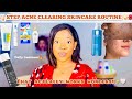 4 STEP ACNE CLEARING SKINCARE ROUTINE THAT ACTUALLY WORKS +Effective Acne Treatment Products.