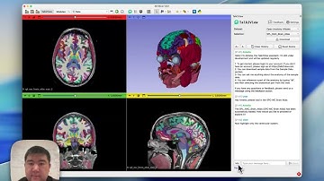 Talk2View Demo - 3D Slicer + Google