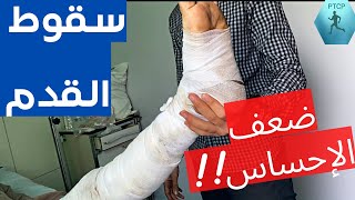 ضعف الاحساس فى القدمين/سقوط القدم /ضعف الاتزان