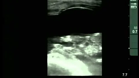 Cow #4539 Day 71 of Gestation