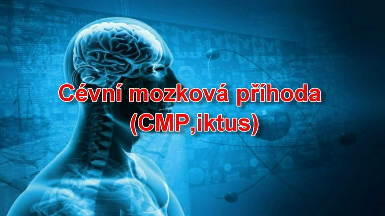 Cévní mozková příhoda (CMP, iktus)