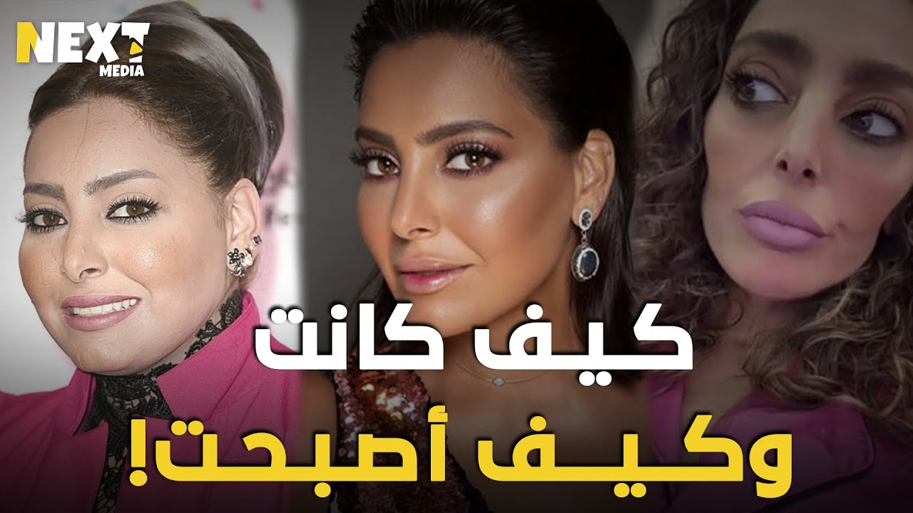 فاطمة الصفي الفنانة الخليجية التي خسرت كل وزنها ووصفوها بالمومياء