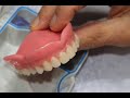 How to make your own denturesdiy denture