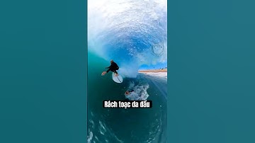 Ván Lướt Sóng Đập Vào Đầu – Cái Kết Rùng Rợn! 😱