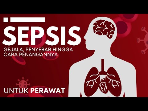 Video: Apakah sepsis selalu berakibat fatal?