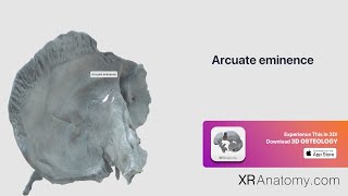 Temporal Bone - Arcuate eminence screenshot 4