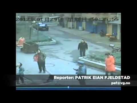 Manhole Cover Explode In The Face Of A Man