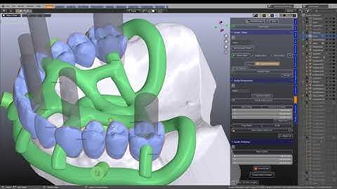 Stack-able Guide B4D Guide Module