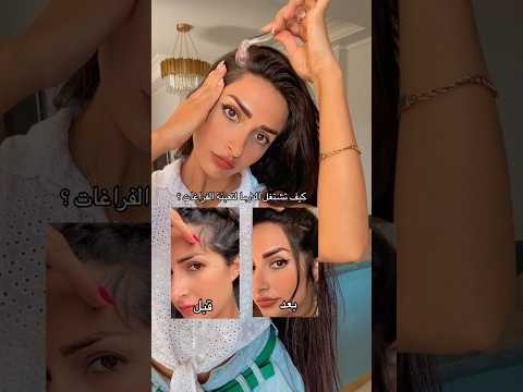 هيدي تجربتي مع الدرما رولر وانتو شو تساقط شعر خلطات شعر  العنايه بالشعر درما