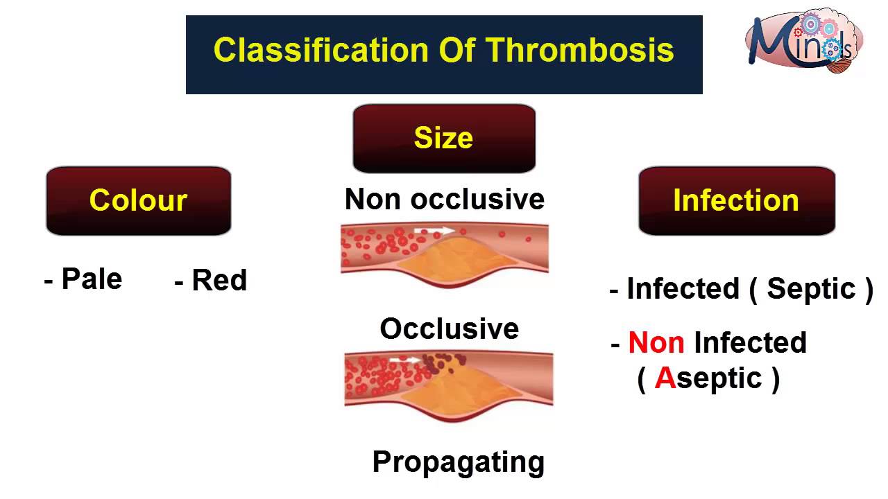 Pathology 3D / Circulation - Thrombosis - - YouTube