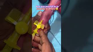 #NICU IV Cannula Procedure for Newborn Babies | Precision, Care & Hope in Neonatal Intensive Care 👶