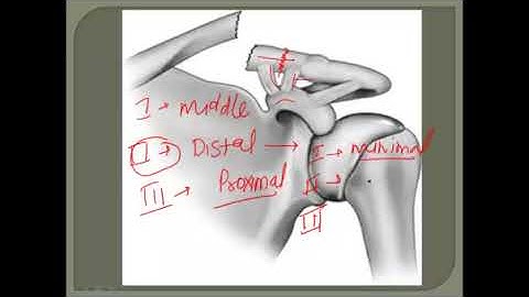 CLASSIFICATION OF CLAVICLE FRACTURE
