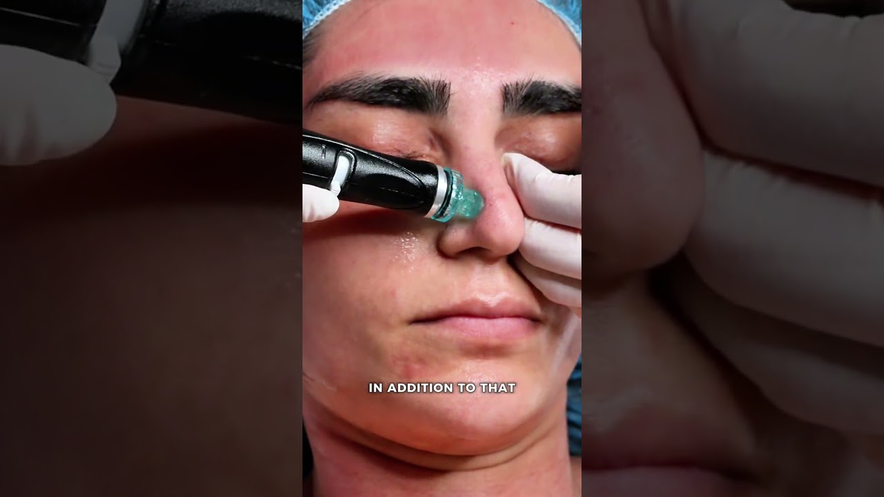 Banner for ✨ This bride's pre-wedding skin prep started three months before 