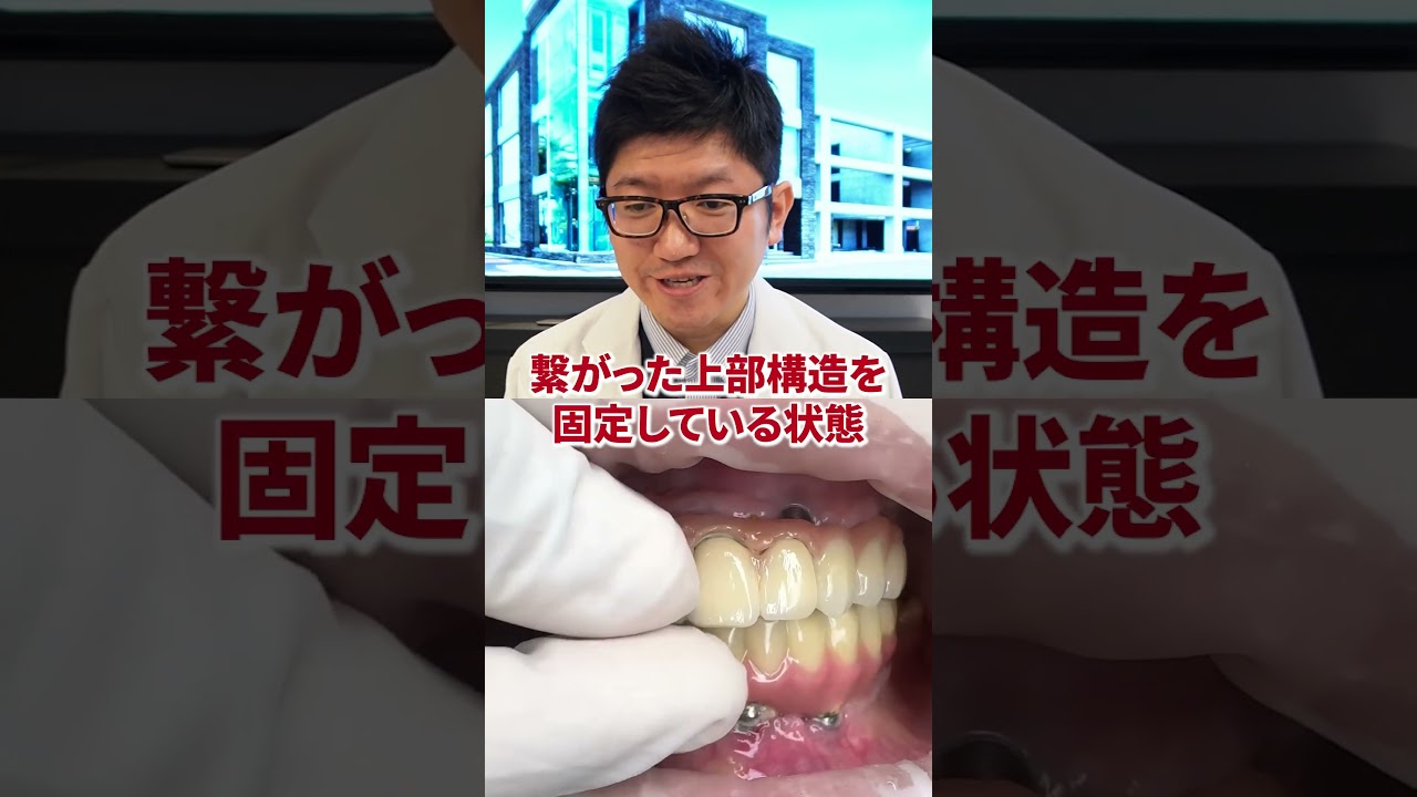 【インプラント】フルマウスのボーンアンカードブリッジ治療を先生が説明!