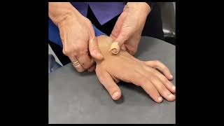 Restoration of Hand Function - Bobath Concept