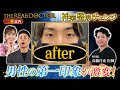【二重埋没法】男性の第一印象を激変させる町田の神業ドクター #湘南美容クリニック