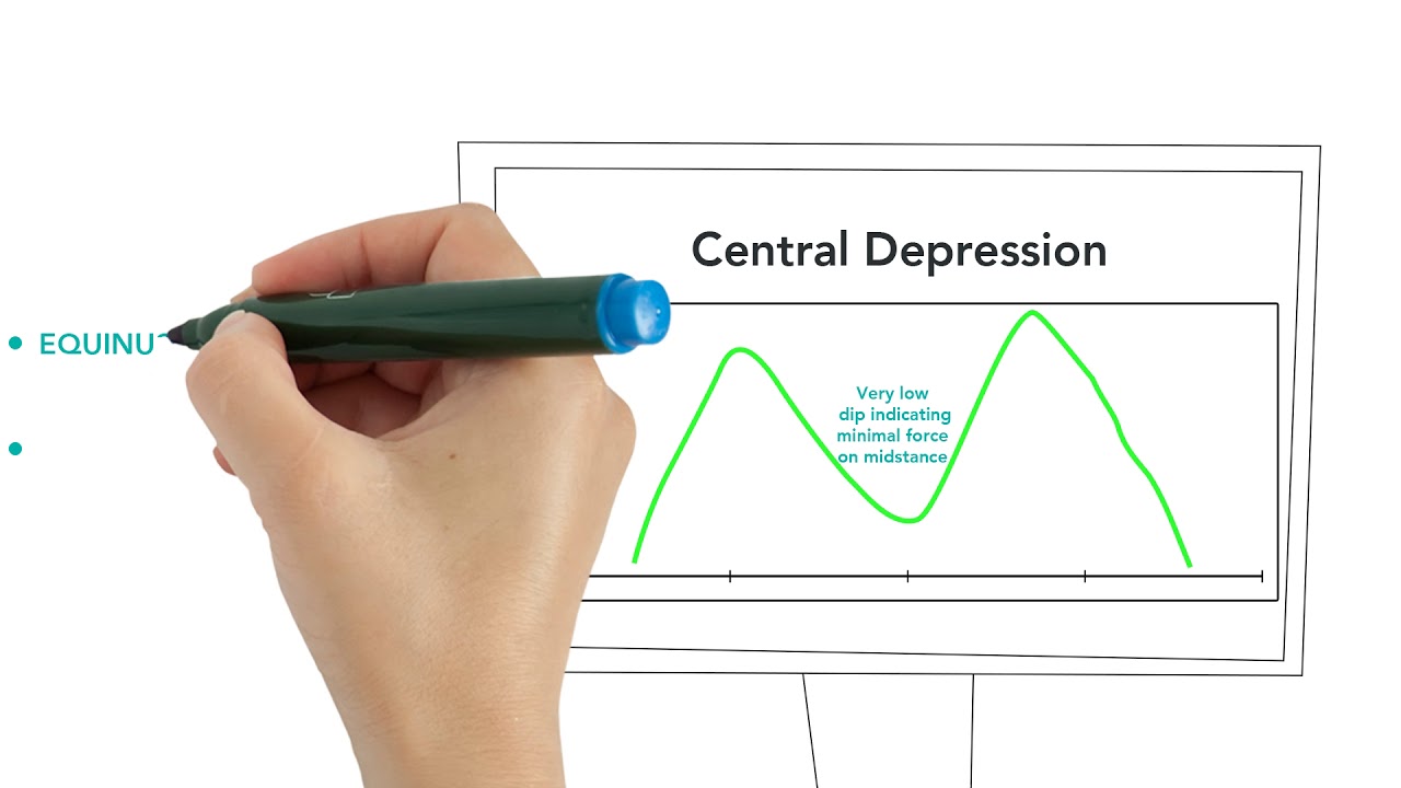 Clinical Interpretations of the Gait Curve