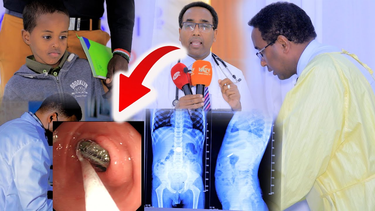 Wiil Naftiisu Halis Gashay Oo Uu Badabadiyay City Hospital.