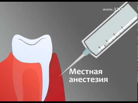 Лечение десен аппаратом Вектор (Vector)