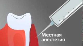 Лечение десен аппаратом Вектор (Vector)(, 2010-10-06T09:55:55.000Z)