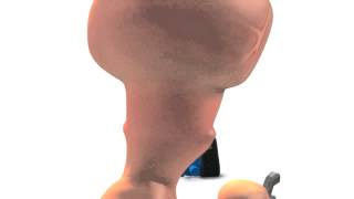 Codename: Sentry (Worms Revolution)