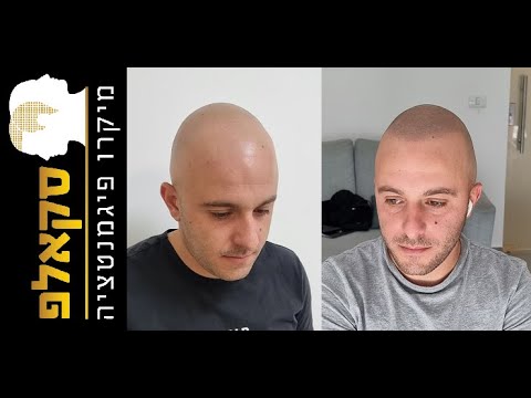 סרטון המלצה על סקאלפ