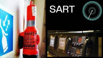 SART - The complete guide.