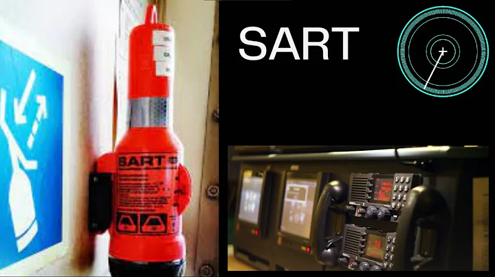 SART - The complete guide.