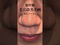 毛穴改善 涙の最終回🥺