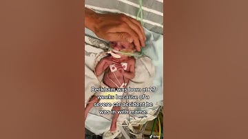 NICU WARRIOR BORN AT 27 WEEKS