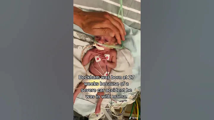 NICU WARRIOR BORN AT 27 WEEKS - DayDayNews
