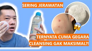 THIS! MICELLAR WATER ANTI ACNE PERTAMA... GARNIER MICELLAR SALICYLIC BHA JERAWAT #MicellarDuluDong screenshot 2