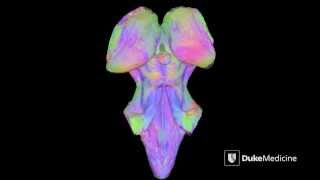 A 3D Map of the Human Brain Stem