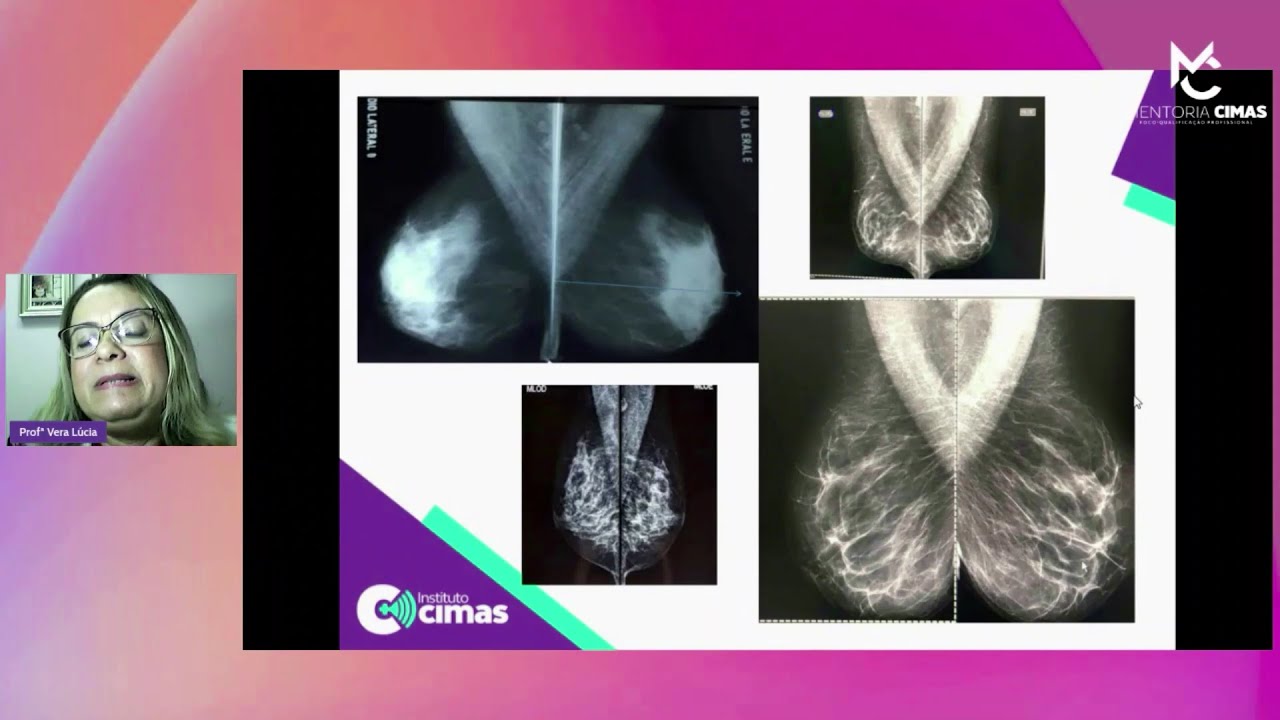 É ASSIM QUE SE FAZ UM BOM EXAME DE MAMOGRAFIA