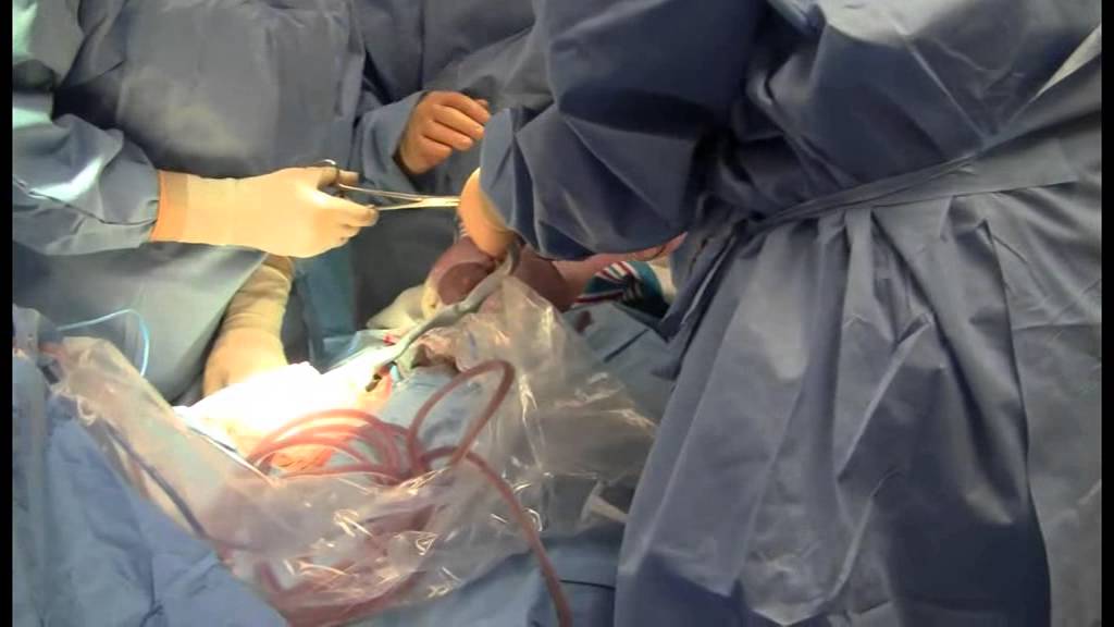 Pulling baby out by the head? YouTube