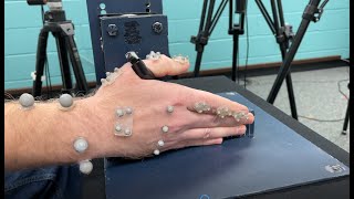 3D Technology Looks for Osteoarthritis