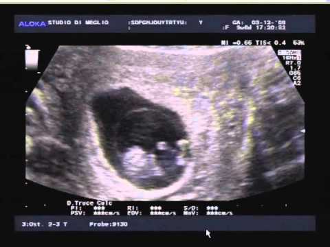 Video: 7 settimane di sviluppo del bambino