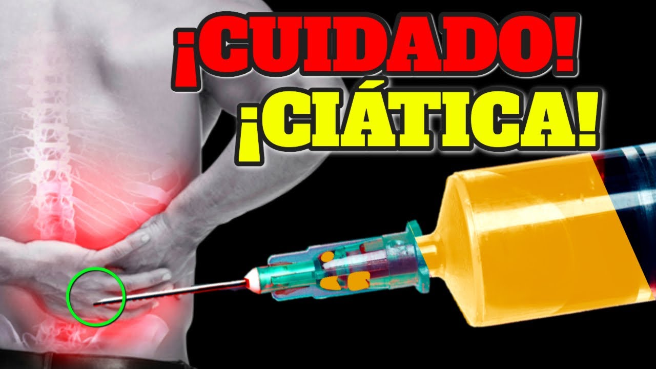 �REVELADO! Esto es bueno para CURAR el dolor del nervio ci�tico