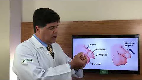 É possível conviver com fimose?