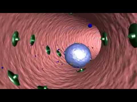 Video: Validierung Des CancerMath-Prognosetools Für Brustkrebs In Südostasien