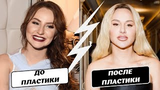 До/VS/После! Знаменитые украинские и российские женщины, которых изменила пластика!