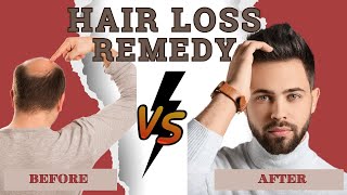 HAIR LOSS FACTS- Natural Remedies to Beat Hair Loss Without Breaking the Bank- Hair Loss Solutions
