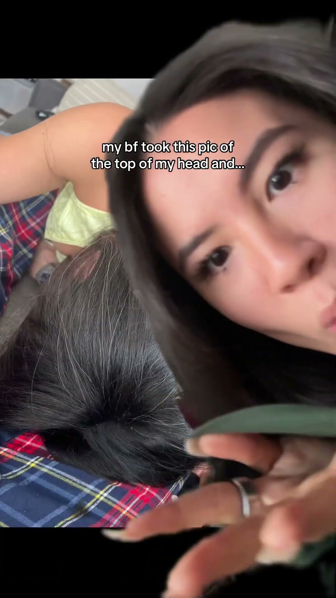 this is what the top of my head looks like????